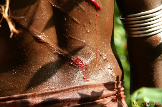 Espalda sangrando - Valle del Omo - Etiopia